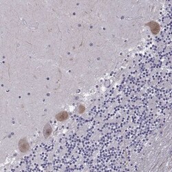 FGF-3 Antibody, Novus Biologicals:Antibodies:Primary Antibodies